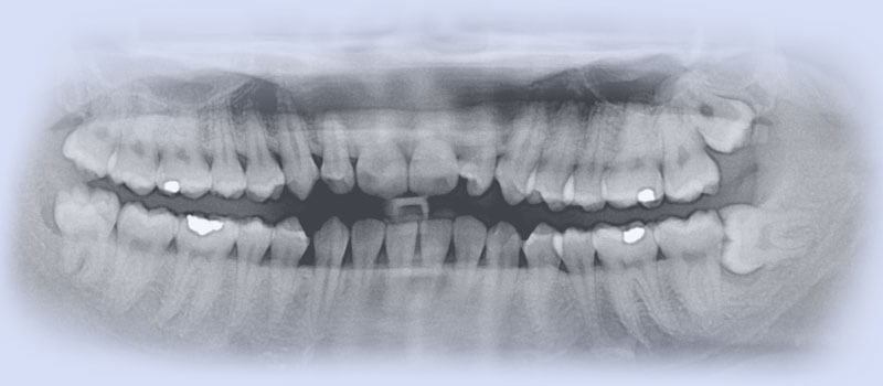 Oralchirurgie Mundhöhle - Zahnarzt Praxis Papczyk in Gera