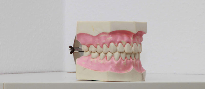 Zahnersatz Banner Zahnschiene - Zahnarzt Praxis Papczyk in Gera